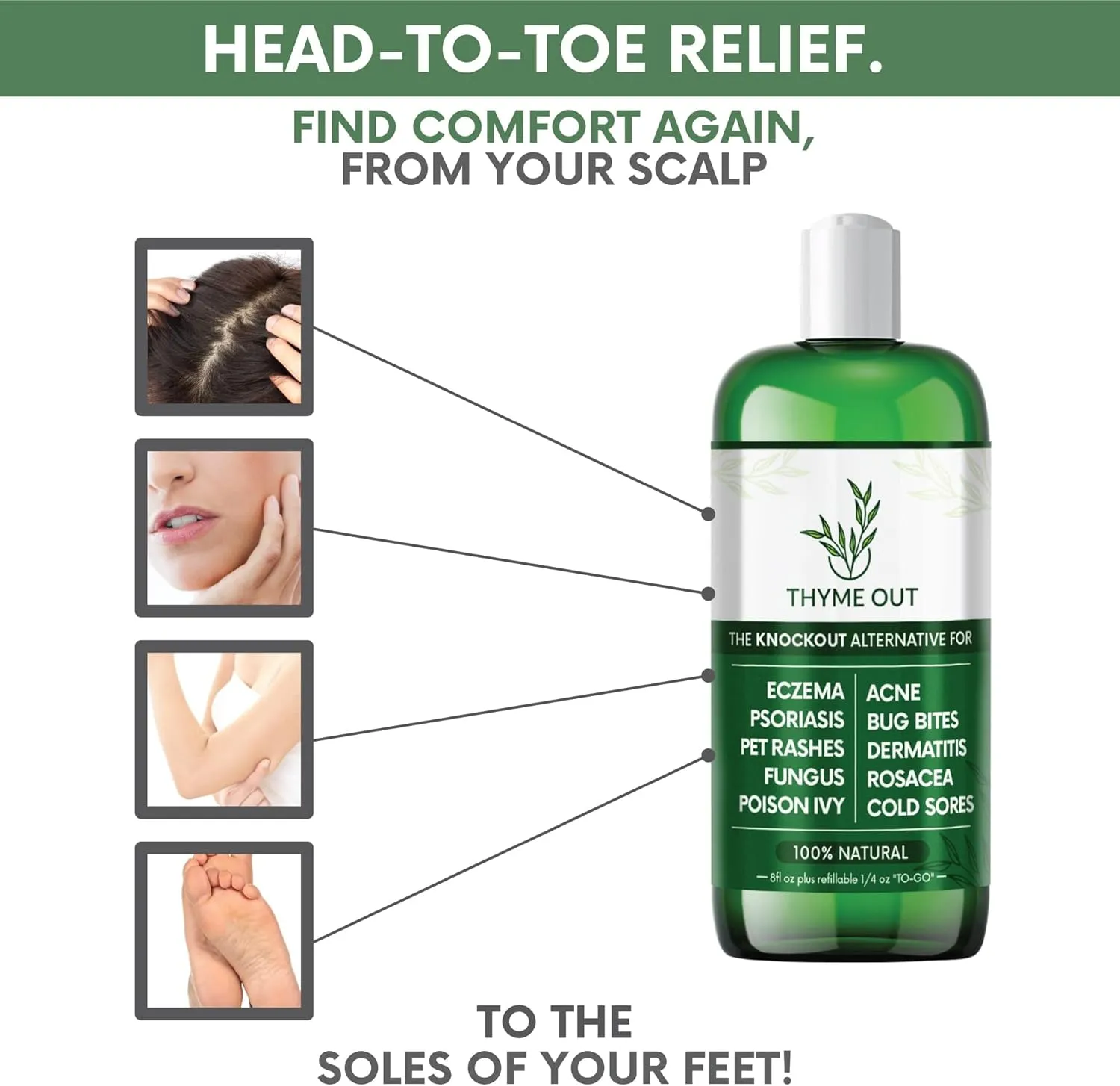 All Natural Eczema Treatment- Psoriasis Treatment - an All-in-One Solution for Acne, Dermatitis, Rosacea, Cold Sores, Pet Rashes, Bug Bites, and Poison Ivy - Anti-Itch Spray for Itchy Skin Relief